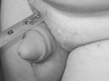 20P Tiny