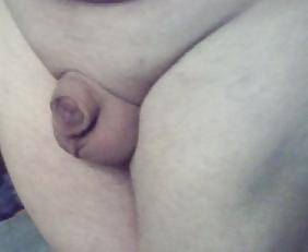20P Tiny