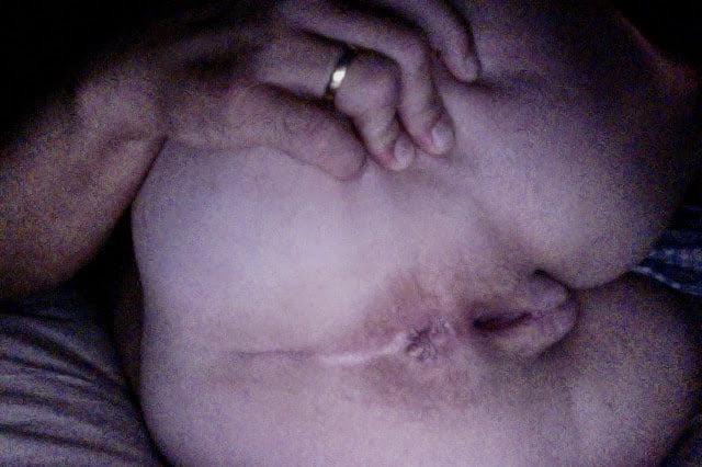 25P asshole