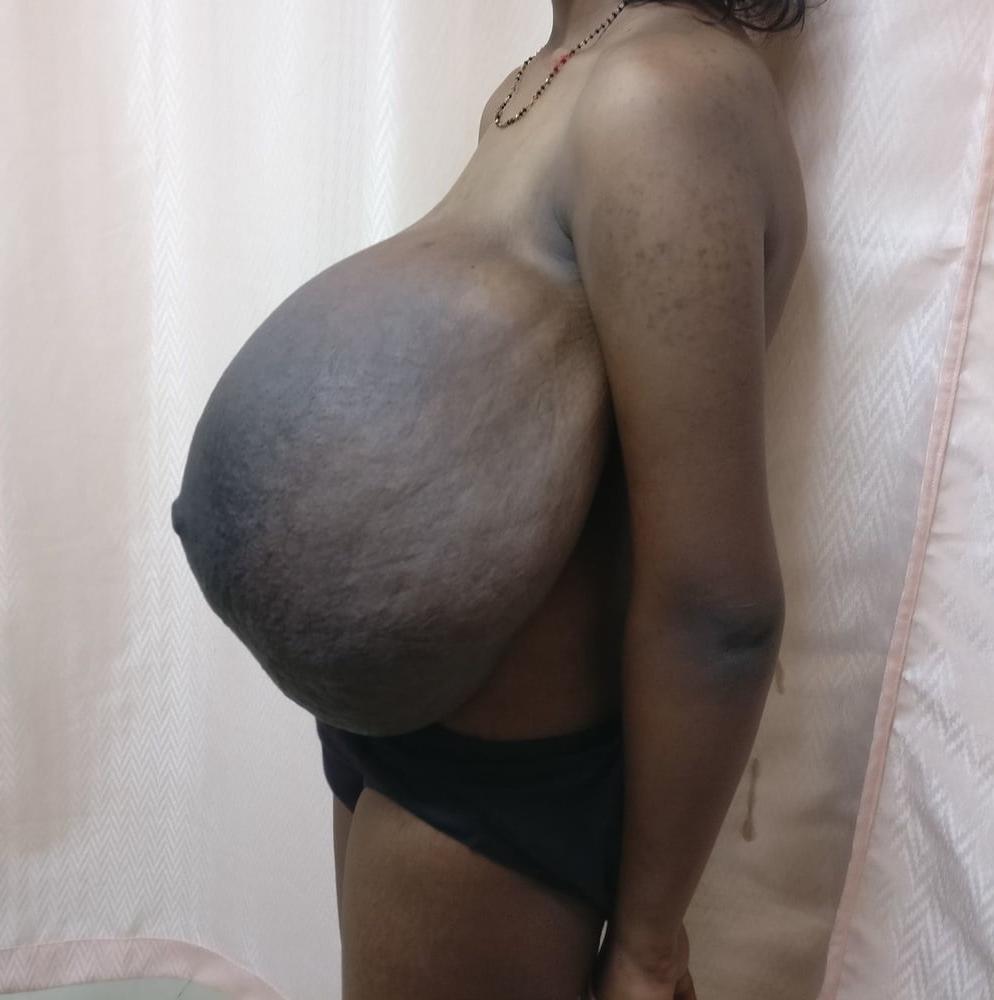12P Super monster huge tits