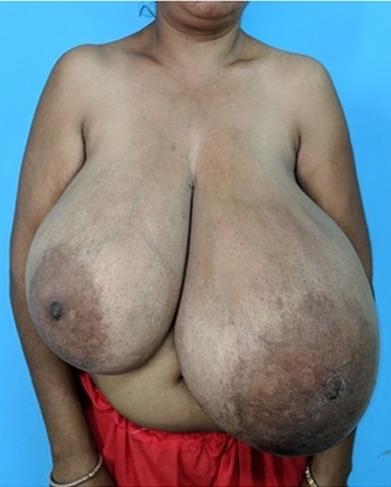 12P Super monster huge tits