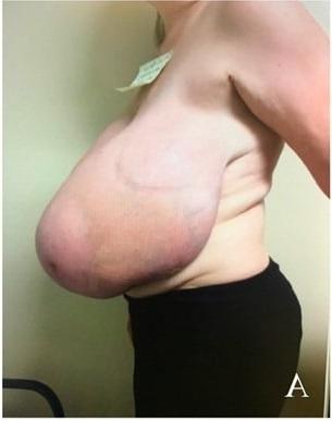 12P Super monster huge tits