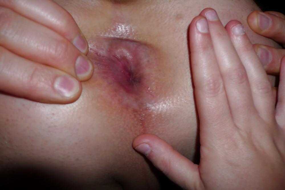 6P My girl is fistin my asshole.....2010