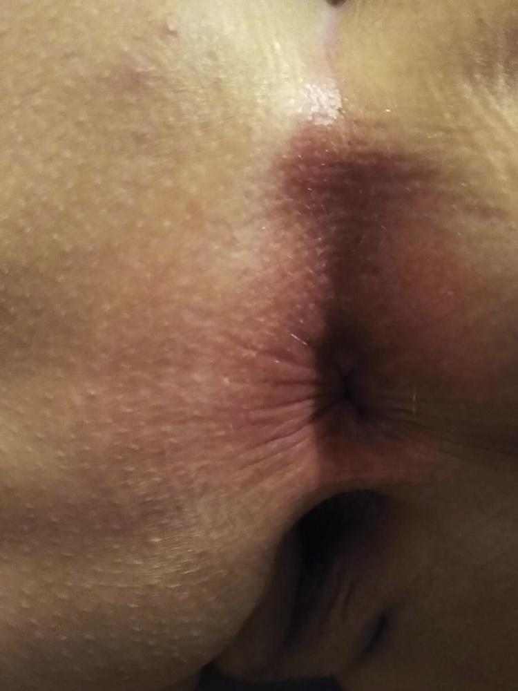 21P Pussy &amp; Butthole 04