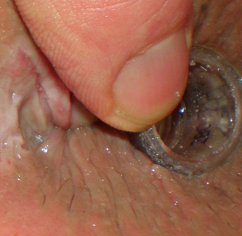 25P My 18 yo horny butthole