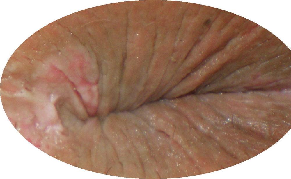 25P My 18 yo horny butthole