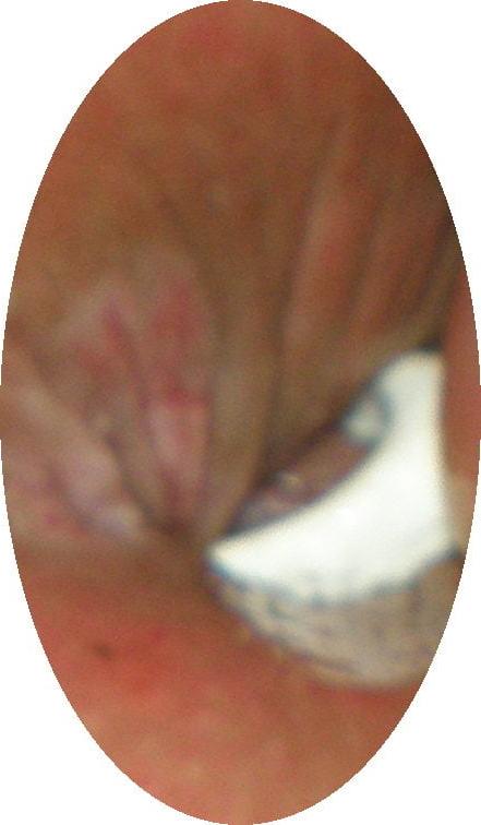 25P My 18 yo horny butthole