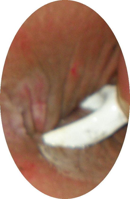 25P My 18 yo horny butthole