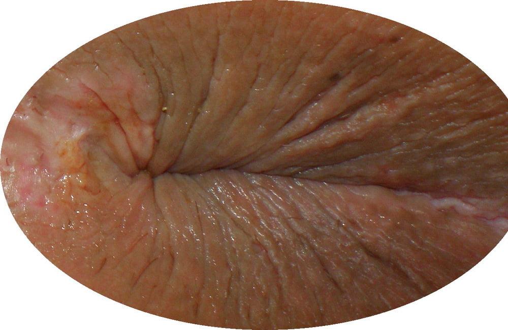 25P My 18 yo horny butthole