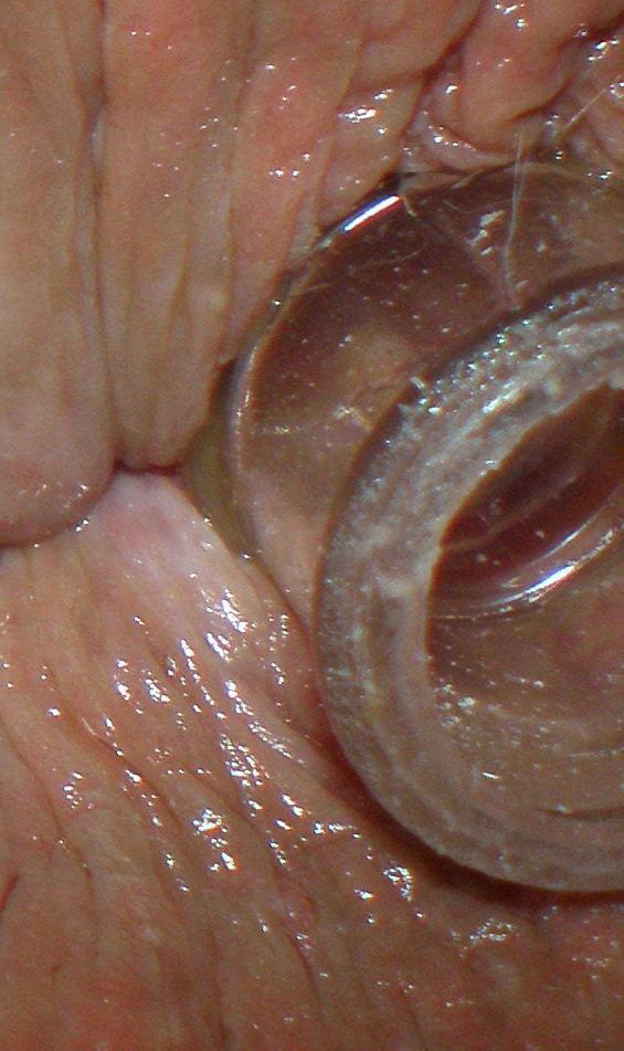 25P My 18 yo horny butthole