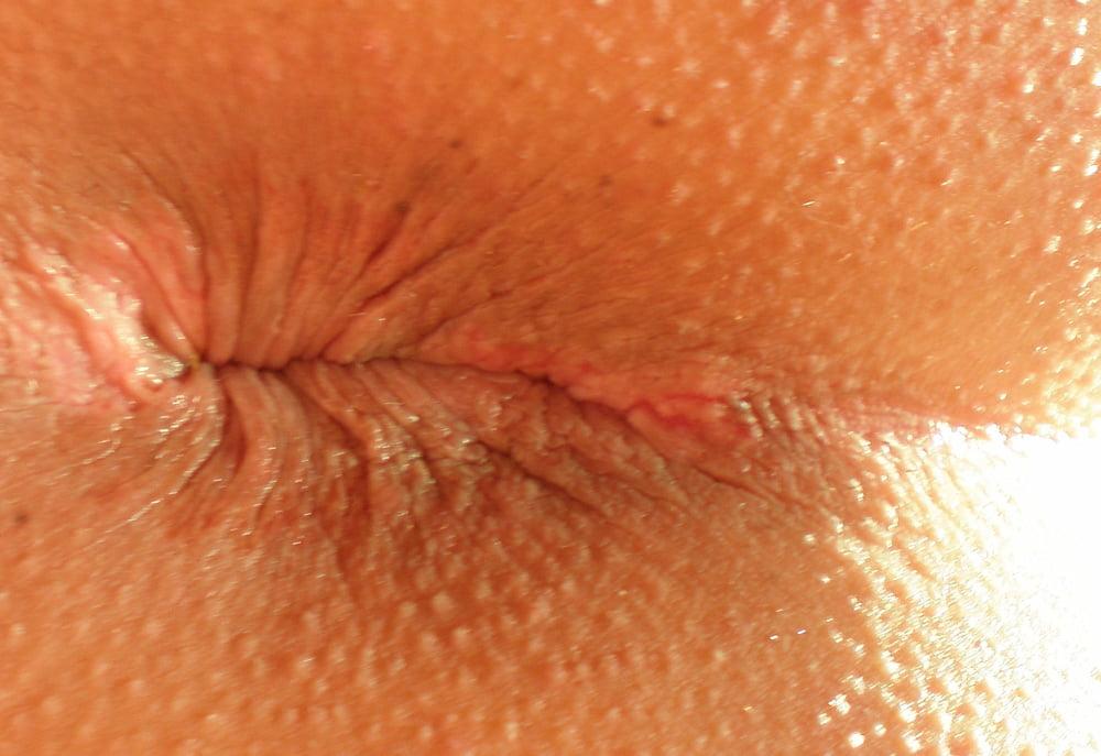 25P My 18 yo horny butthole