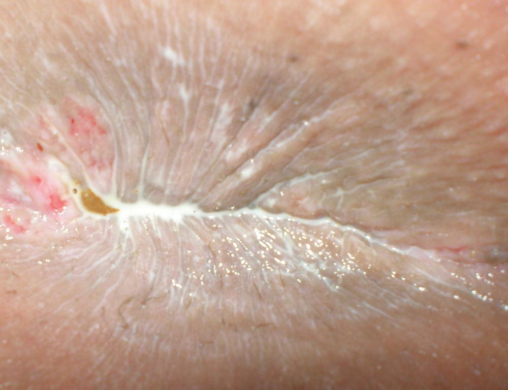 25P My 18 yo horny butthole