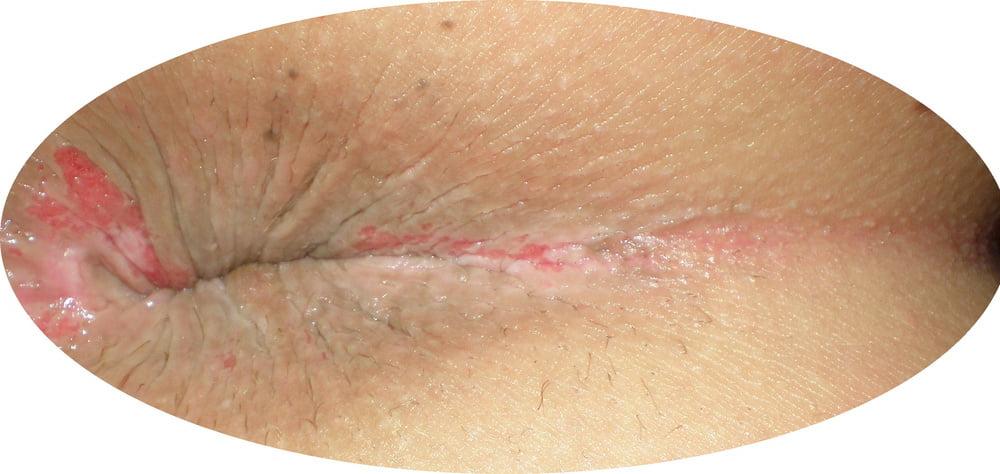 25P My 18 yo horny butthole