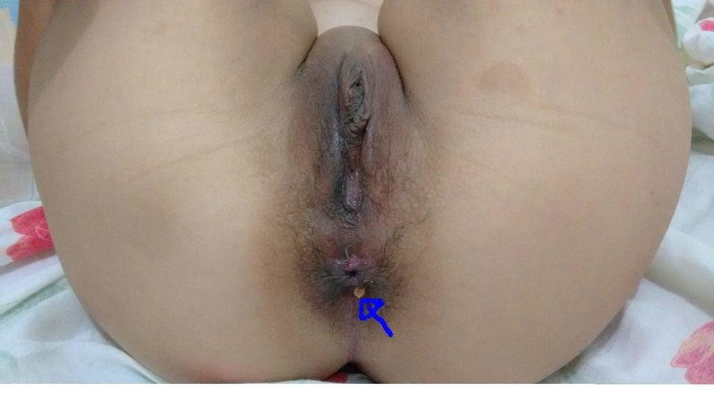 25P Pussy &amp; Butthole 03