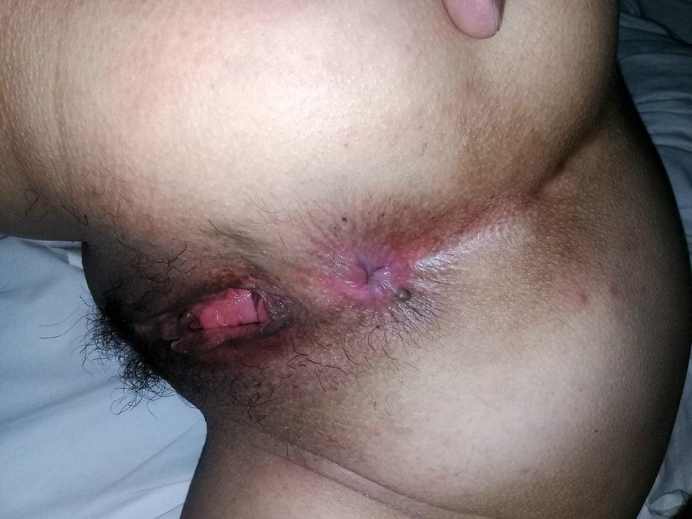 25P Pussy &amp; Butthole 03