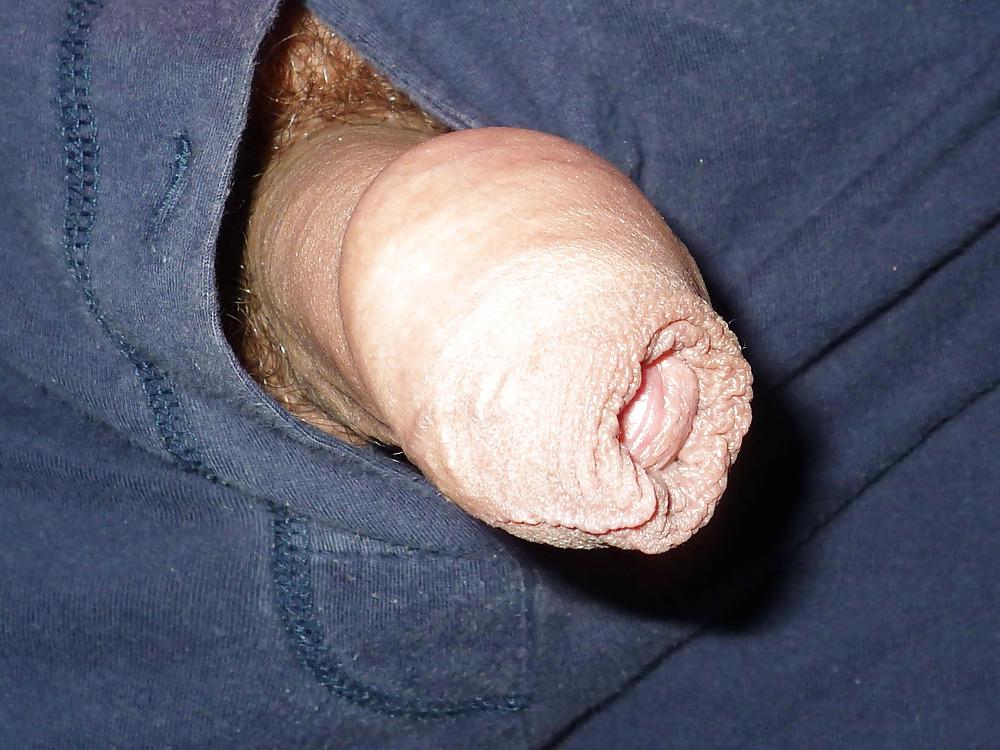 15P Penis with foreskin