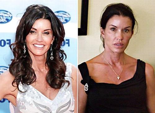 20P Celebs B4 After Make Up By TROC