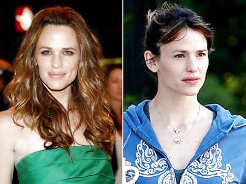 20P Celebs B4 After Make Up By TROC