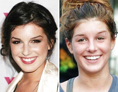 20P Celebs B4 After Make Up By TROC