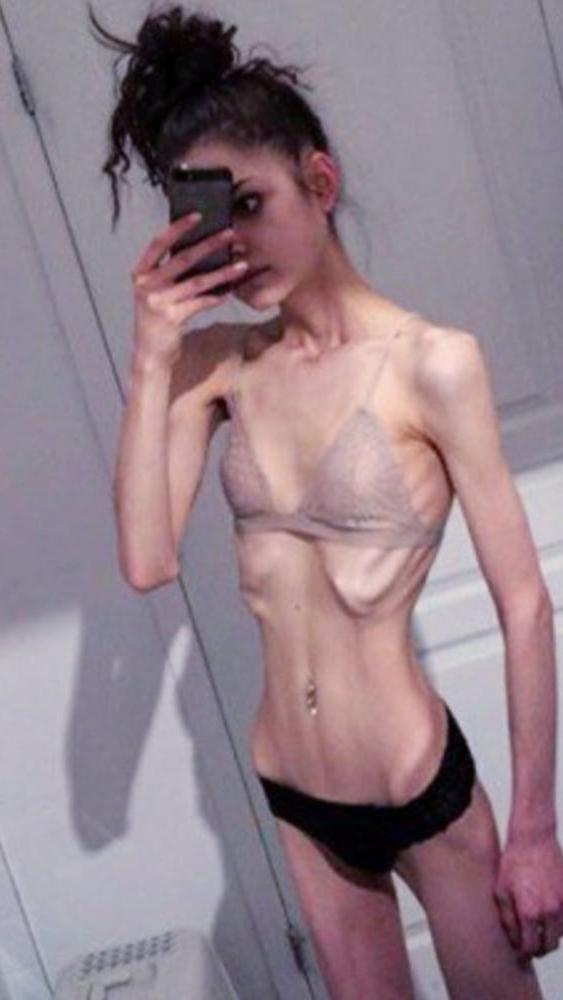25P Skinny gallery 6