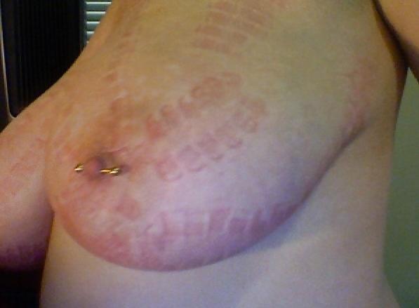 25P Big Natural Boobs Tortured With Over 100 pegs Vol1