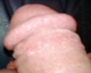 5P Dick cameltoe