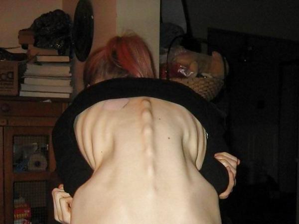 13P Skinny chicks