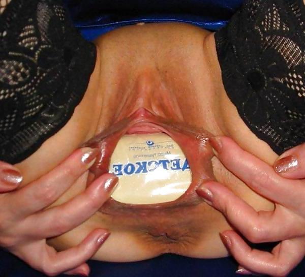 15P Odd Insertions!