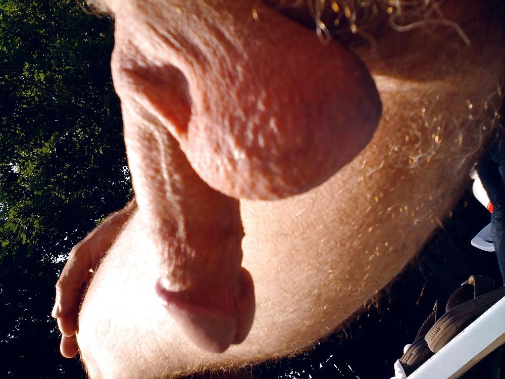 16P Penis in the sun