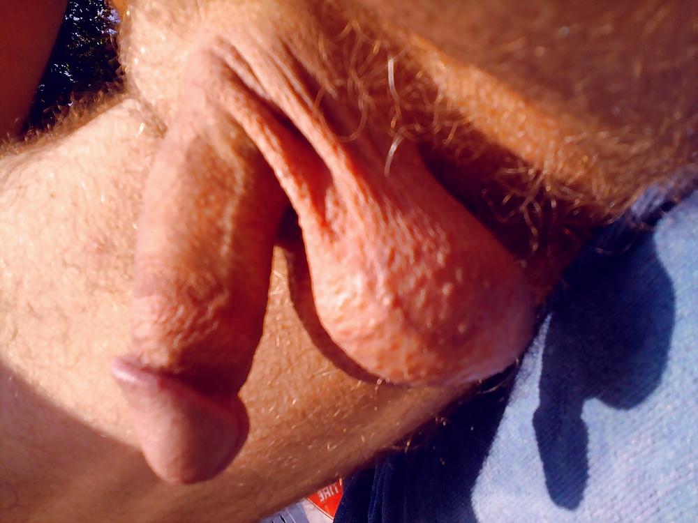 16P Penis in the sun