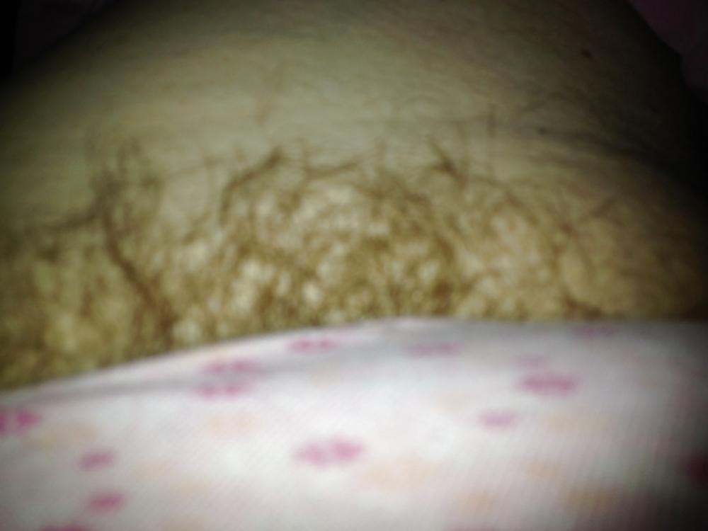 25P My bbw hairy pussy and titts.