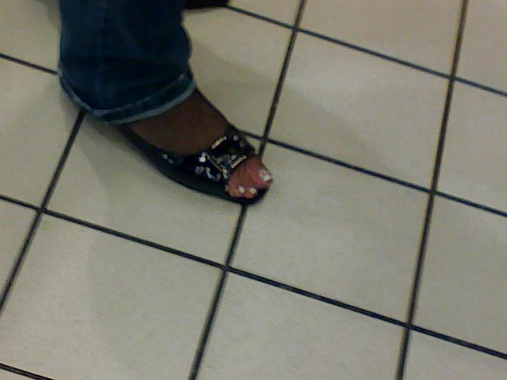 16P Nylon Feet 1