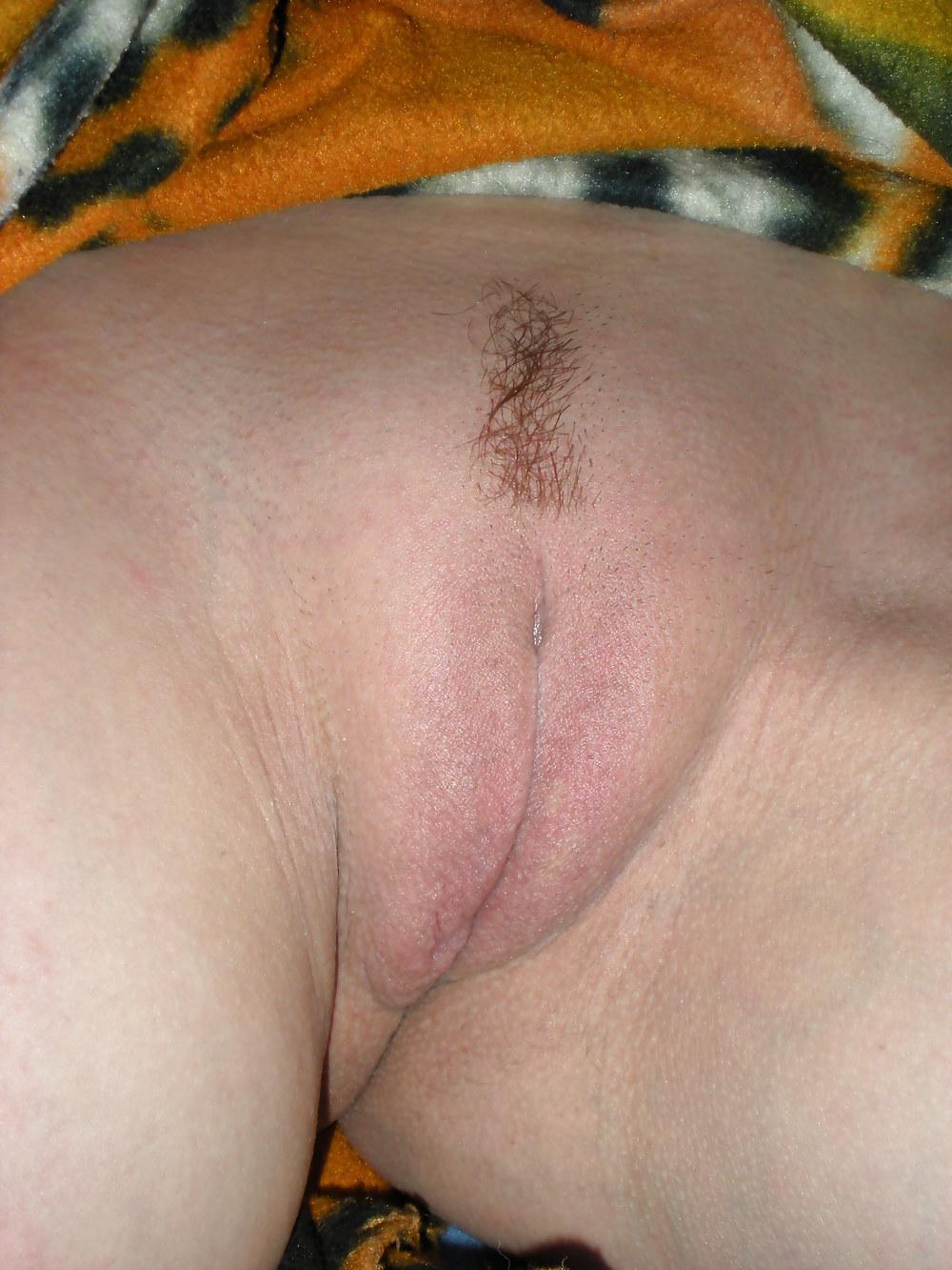 14P Rasage