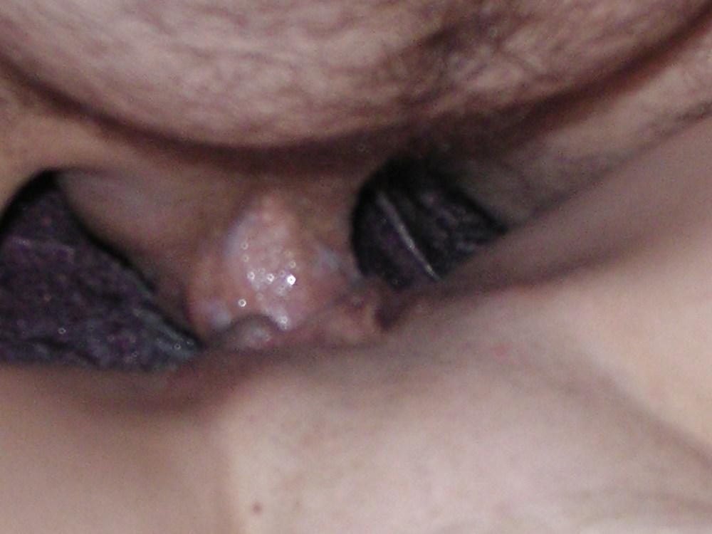 25P Mature XII - Couple Part II