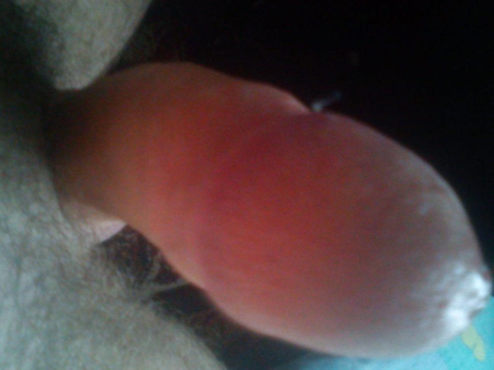 6P My penis
