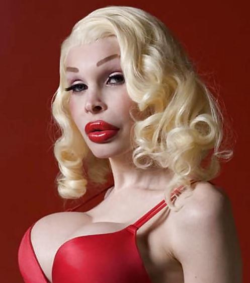 18P Bad Plastic Surgeries  