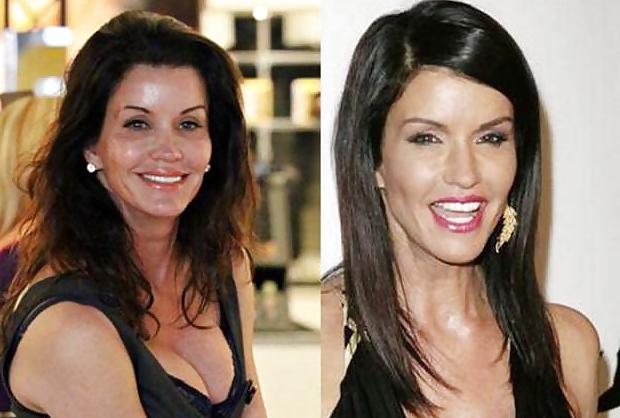 18P Bad Plastic Surgeries  