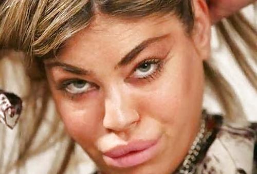 18P Bad Plastic Surgeries  