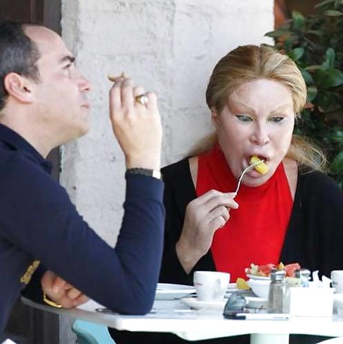 18P Bad Plastic Surgeries  