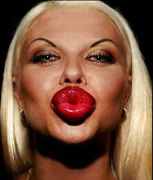 18P Bad Plastic Surgeries  