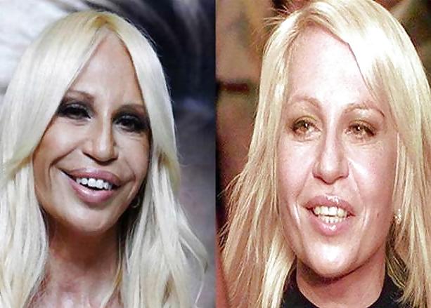 18P Bad Plastic Surgeries  