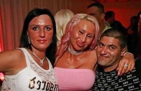 18P Bad Plastic Surgeries  