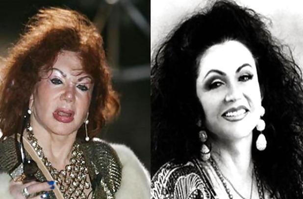 18P Bad Plastic Surgeries  