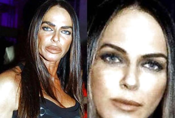 18P Bad Plastic Surgeries  