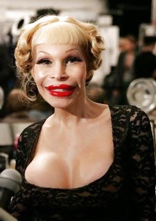 18P Bad Plastic Surgeries  