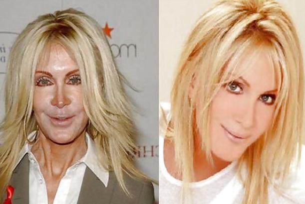 18P Bad Plastic Surgeries  
