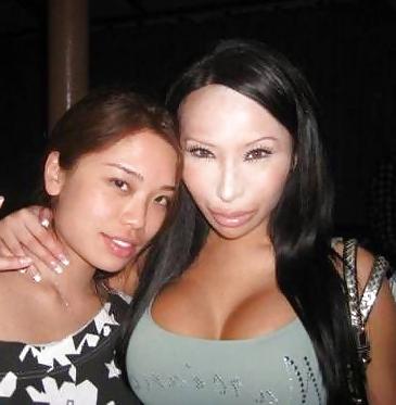 18P Bad Plastic Surgeries  