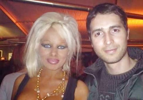 18P Bad Plastic Surgeries  
