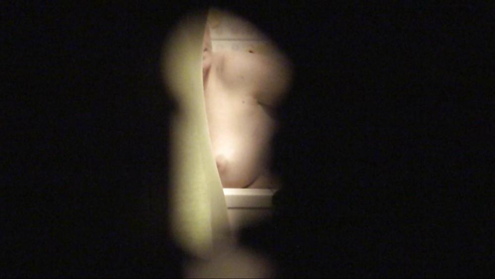 12P Keyhole