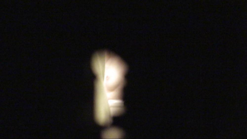 12P Keyhole